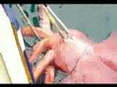colossal_squid_caught_video